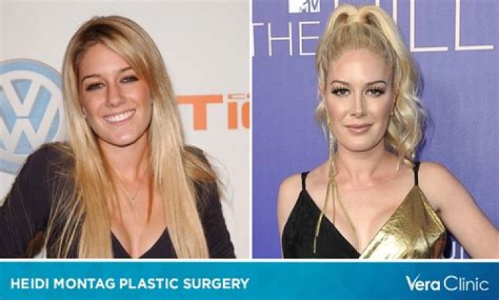 Heidi Montag's Pre-Surgery Transformation: An Unrecognizable Beauty